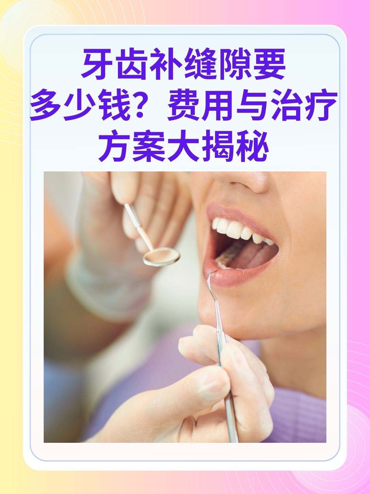 唐山补牙医保可以报销吗(补牙医保可以报销吗 哪些可以报销呢)